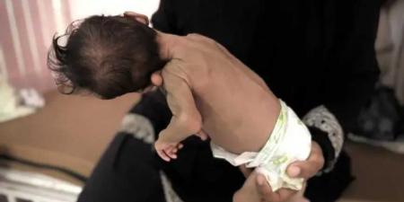 الأونروا تحذر: أطفال غزة مهددون بالموت بسبب التجويع