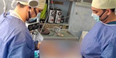 تفاصيل إجراء أول عملية جراحية لاستئصال ورم بالمخ باستخدام تقنية «الجراحة في حالة اليقظة»