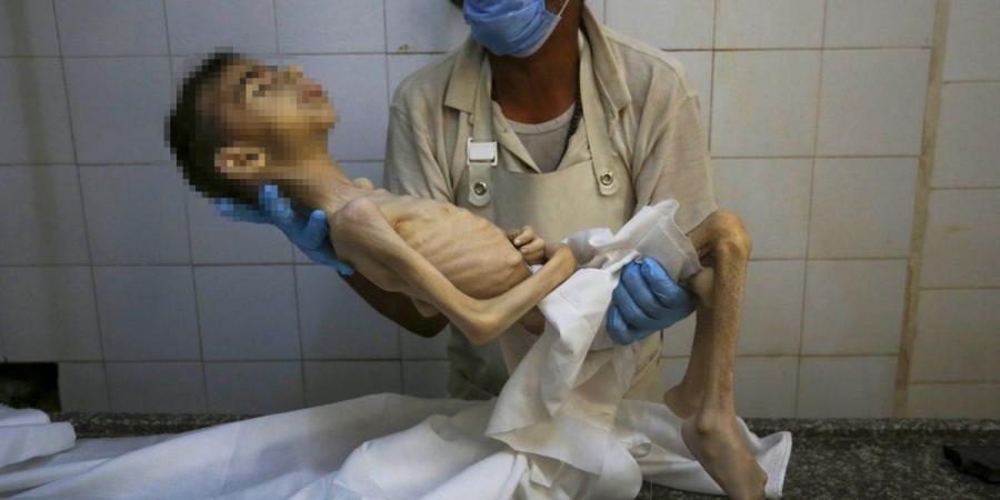 أونروا: 40 ألف طفل قُتلوا أو أُصيبوا بالقصف الاسرائيلي في غزة